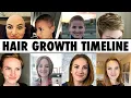 Download Lagu Post Chemo HAIR GROWTH (What to EXPECT)