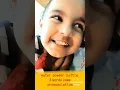 Lisping of kids