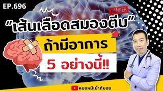 ทำไมการมีอาการหน้าเบี้ยวหรือมุมปากตกจึงควรสงสัยว่าอาจเกิดจากเส้นเลือดในสมองตีบ