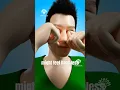 Download Lagu What Happens If You Rub Your Eyes Too Much? 😨 #Keratoconus #shorts - creativelearning3d