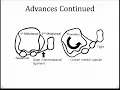 Let s talk about Bunions