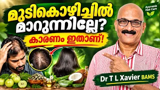 കഷണ്ടി വരാതിരിക്കാൻ എന്ത് ചെയ്യണം? | Dr T L Xavier