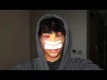 the truth about my nose job in korea