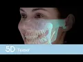RAY 5D Teaser s