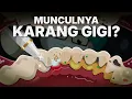 Lagu Dari Mana Asal Karang Gigi Sebenarnya?
