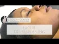 DERMAPLANING Procedure How-To with Before After
