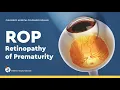 Retinopathy of Prematurity Diagnosis and Treatment