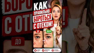Почему вы ОТЕКАЕТЕ? И как это остановить