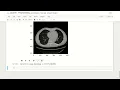 7 Data Formats in Medical Imaging - 8 Preprocessing-in-Python-Part-2