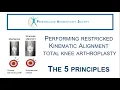 The 5 principles to perform restricted kinematic alignment total knee arthroplasty