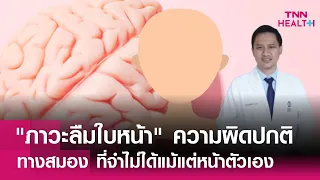  ผู้ป่วยโรคลืมใบหน้าสามารถใช้ชีวิตประจำวันได้ตามปกติหรือไม่ 