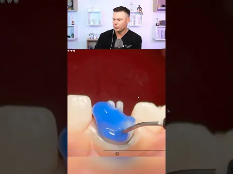 Dentist Reveals What This Blue Liquid REALLY Is! 😮🦷