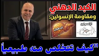 7 علامات قد تكشف مقاومة الإنسولين مع الكبد الدهني