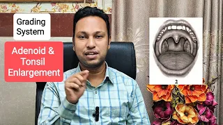 How to Grade Adenoid Tonsillar Enlargement