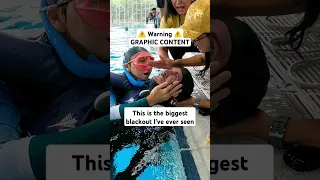 GRAPHIC FREEDIVING ACCIDENT