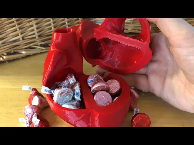 Open Heart Chocolate Box video thumbnail
