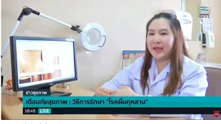 โรคผื่นกุหลาบรักษาอย่างไรคะ