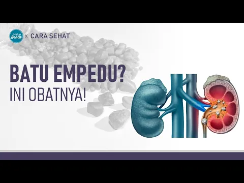 Cara Menyembuhkan Penyakit Batu Empedu