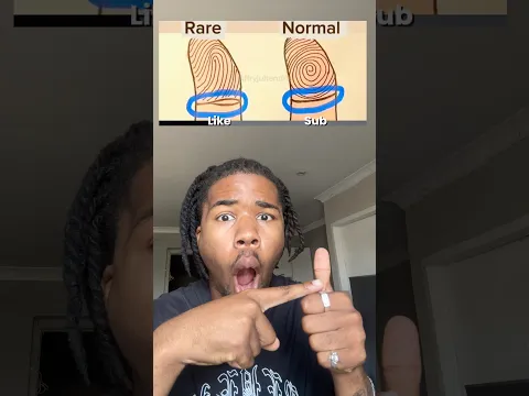 Normal or rare 👀 #shortsfeed #duet #hiphopvibe #exploreshorts #memes #subscribemychannel