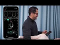 Exo Iris Virtual Demo | Handheld ultrasound, real-time AI, and workflow software.