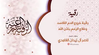 رقية خروج الدم الفاسد بإذن الله الشيخ ناصر زيدان الغامدي 