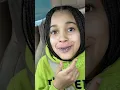 Download Lagu WE FOUND OUT WHAT’S WRONG WITH HER LIPS!! 😲