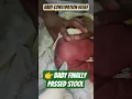 ✨ Newborn Couldn’t Poop! See How Rectal Stimulation Helped Instantly #NewbornConstipation #babycare