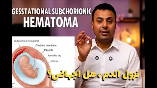 نزول الدم في الحمل  النزيف    هل اجهاض     والحل  دندنها