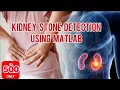 Kidney Stone Detection Using Image Processing Kidney Stone Detection Using MATLAB