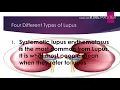 Download Lagu Lupus