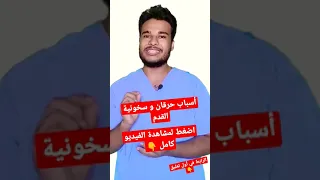 أسباب حرقان و سخونية القدم 