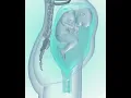 Download Lagu Fetus coming in to birth position (3D Animation)