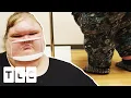 Tammy s Weight Rises Above 600lb Worrying Brother Chris 1000-lb Sisters
