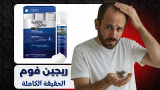 قبل ما تشتري الريجين فوم اسمع الكلام ده الأول   حقيقة مينوكسيديل فوم دندنها