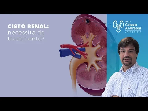 Download MP3 Cisto renal: necessita de tratamento? | Dr. Cassio Andreoni CRM 78.546