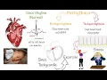 Download Lagu Tachycardia - Most Common causes and Symptoms