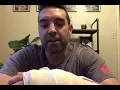 Scapholunate SL Ligament Reconstruction with Arthrex - Day 1