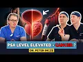 Elevated PSA Test Now What Urologist Explains What s Next
