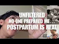 Download Lagu Ongefilterd: Mijn bevallingsverhalen + Postpartum Shock