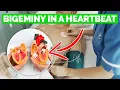 What is BIGEMINY Causes Preventions Cardiac Arrhythmia Explained
