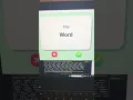 100 Days of code Day 31