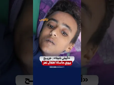 "أيش ذنبنا؟".. طفل جريح يروي مأساة المدنيين في تعز جراء حرب وحصار الحوثيين