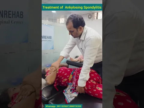 Treatment of Ankylosing spondylitis. एंकाइलोजिंग स्पॉन्डिलाइटिस का इलाज। #ankylosingspondylitis