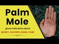 Mole on Palm Mole on Right Palm Mole on Left Palm Facts about Moles on Palm Hath par til