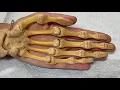Hand Bones