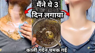 सुबह Coconut Oil से ऐसे नहालो साबुन/फेस वॉश भूल जाओगे|How to get fair skin at home,Fair Body Pack 
