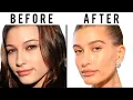 Is Hailey Bieber s Face All Natural Plastic Surgery Analysis