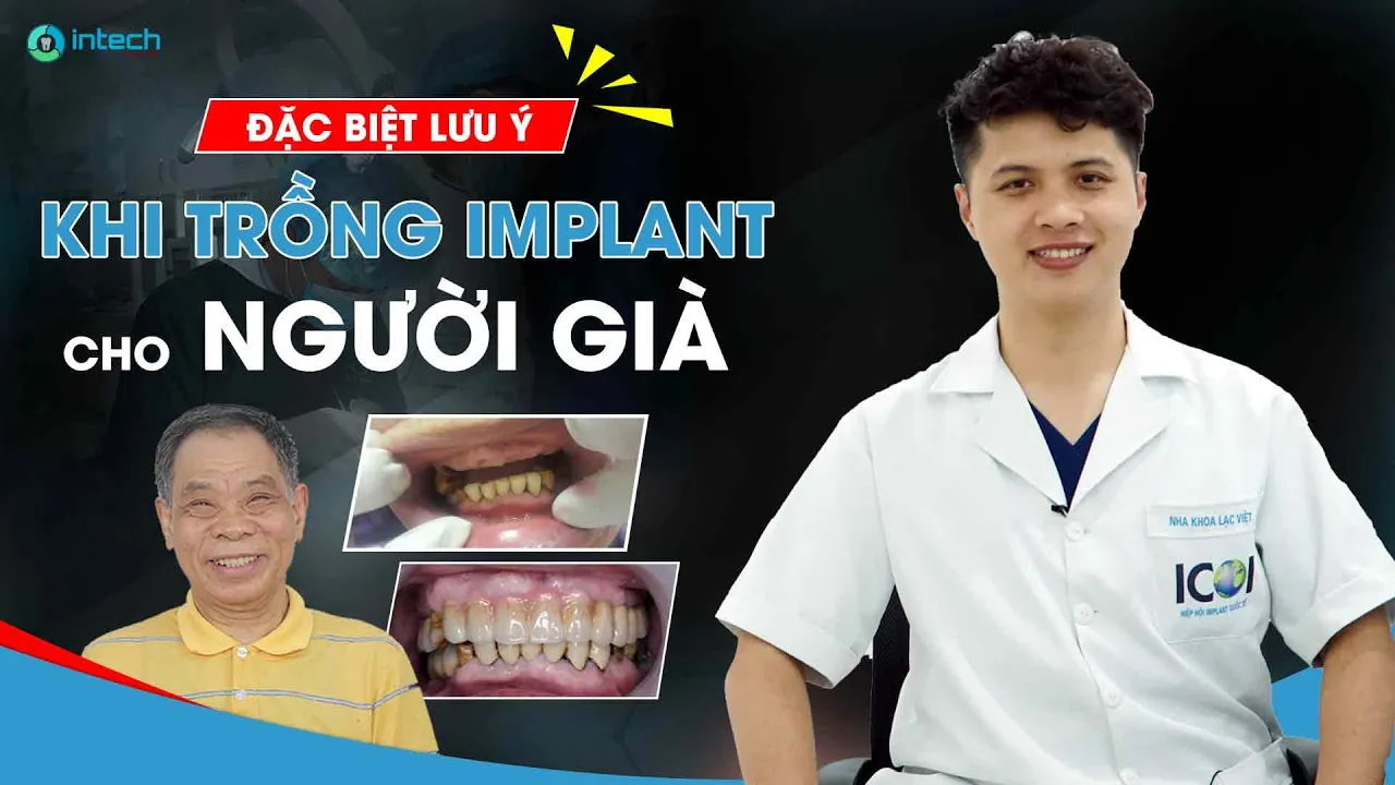 Outline Video Trồng răng implant cho người già || 4 lưu ý tuyệt đối không bỏ qua