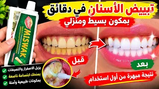 تبييض الاسنان فى ثوانى قسما بالله تزيل الاصفرار تسقط الجير بعد فرك اسنانك بها لن تصدق النتائج