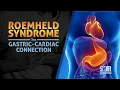 Roemheld Syndrome The Gastric-Cardiac Connection